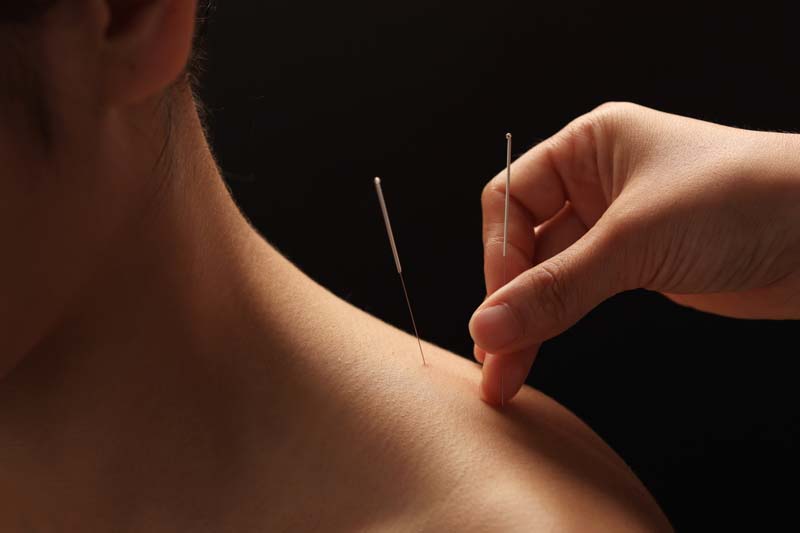 lifepath Acupuncture
